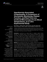 Hypothermia-Associated Coagulopathy: A Comparison of Viscoelastic Monitoring, Platelet Function, and Real Time Live Confocal Microscopy at Low Blood Temperatures, an&nbsp;in vitro&nbsp;Experimental Study