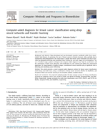 Computer-Aided Diagnosis for Breast Cancer Classification using Deep Neural Networks and Transfer Learning