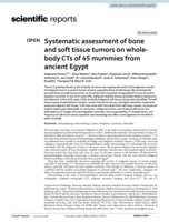 Systematic assessment of bone and soft tissue tumors on wholebody CTs of 45 mummies from ancient Egypt