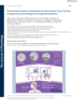 Preferential lactate metabolism in the human brain during exogenous and endogenous hyperlactataemia