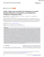 Hallux Valgus and Associated Foot Pathology in Ancient Egyptian Mummies: A Qualitative and Quantitative Computed Tomography Study